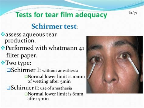 tears test|schirmer test without anesthesia.